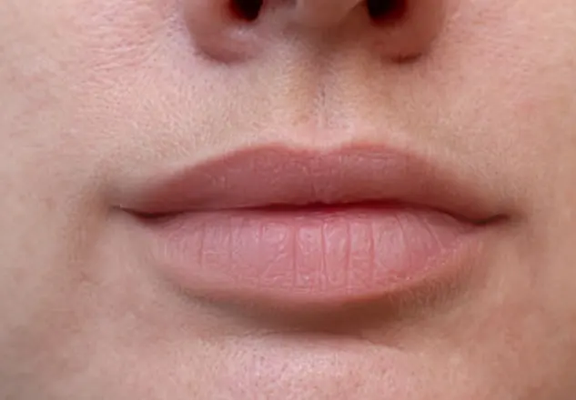 BEFORE & AFTER v1