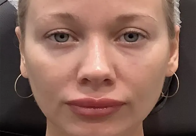 BEFORE & AFTER v2